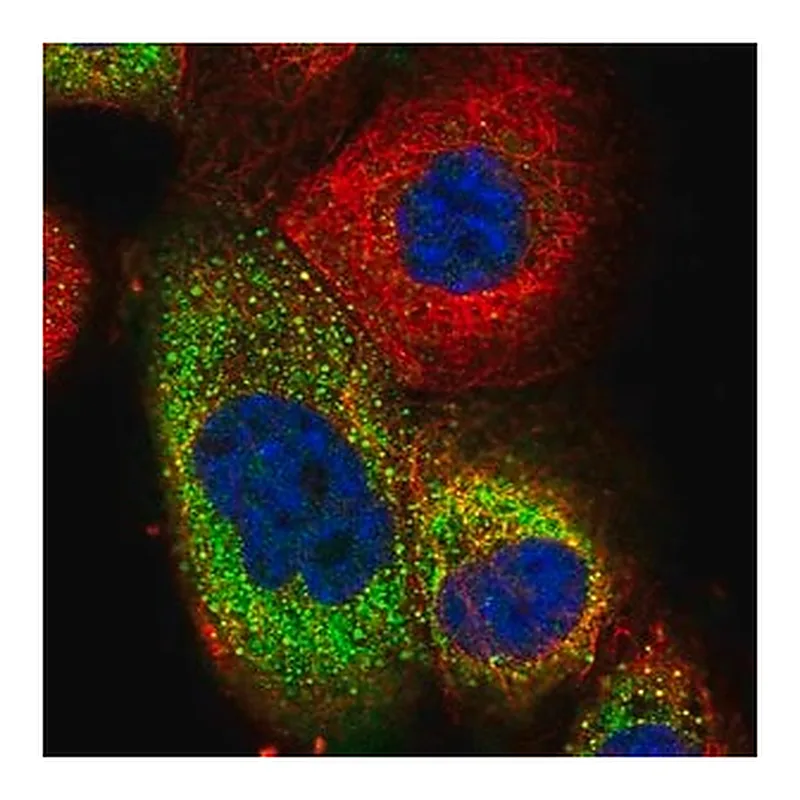 Merck Anti-TRIM73 antibody produced in rabbit