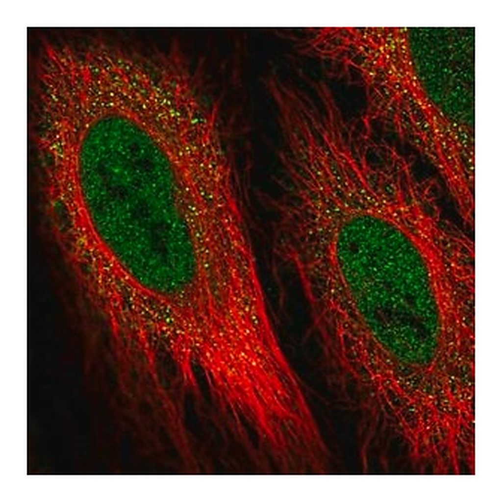 Merck Anti-DIO2 antibody produced in rabbit