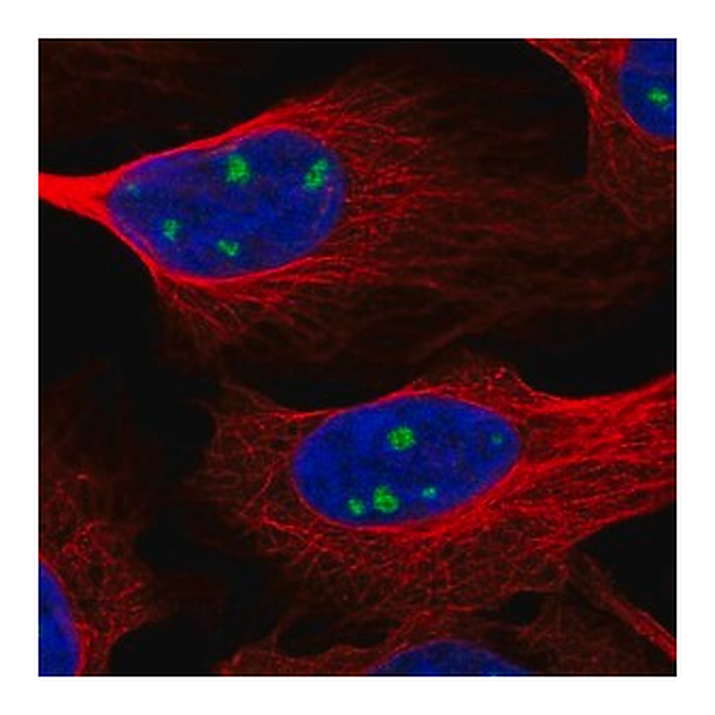 Merck Anti-NTRK3 antibody produced in rabbit