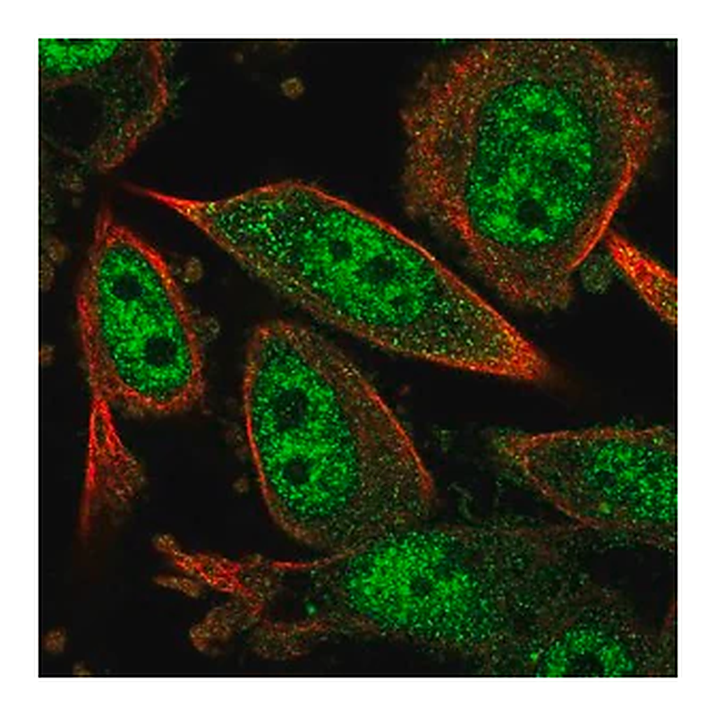Merck Anti-CARM1 antibody produced in rabbit