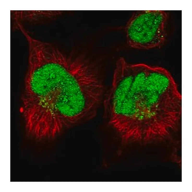 Merck Anti-ANKRD49 antibody produced in rabbit