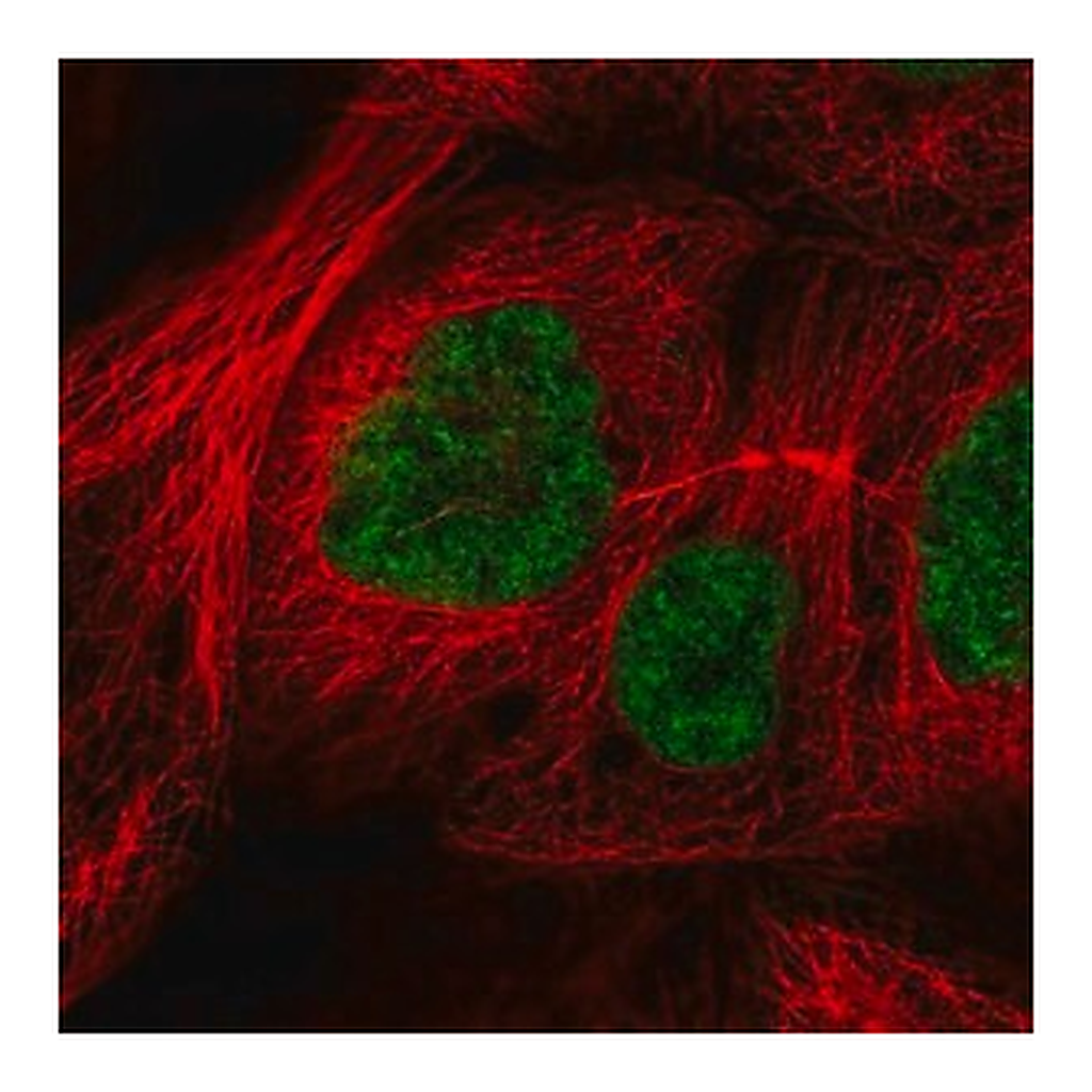 Merck Anti-RSRC2 antibody produced in rabbit