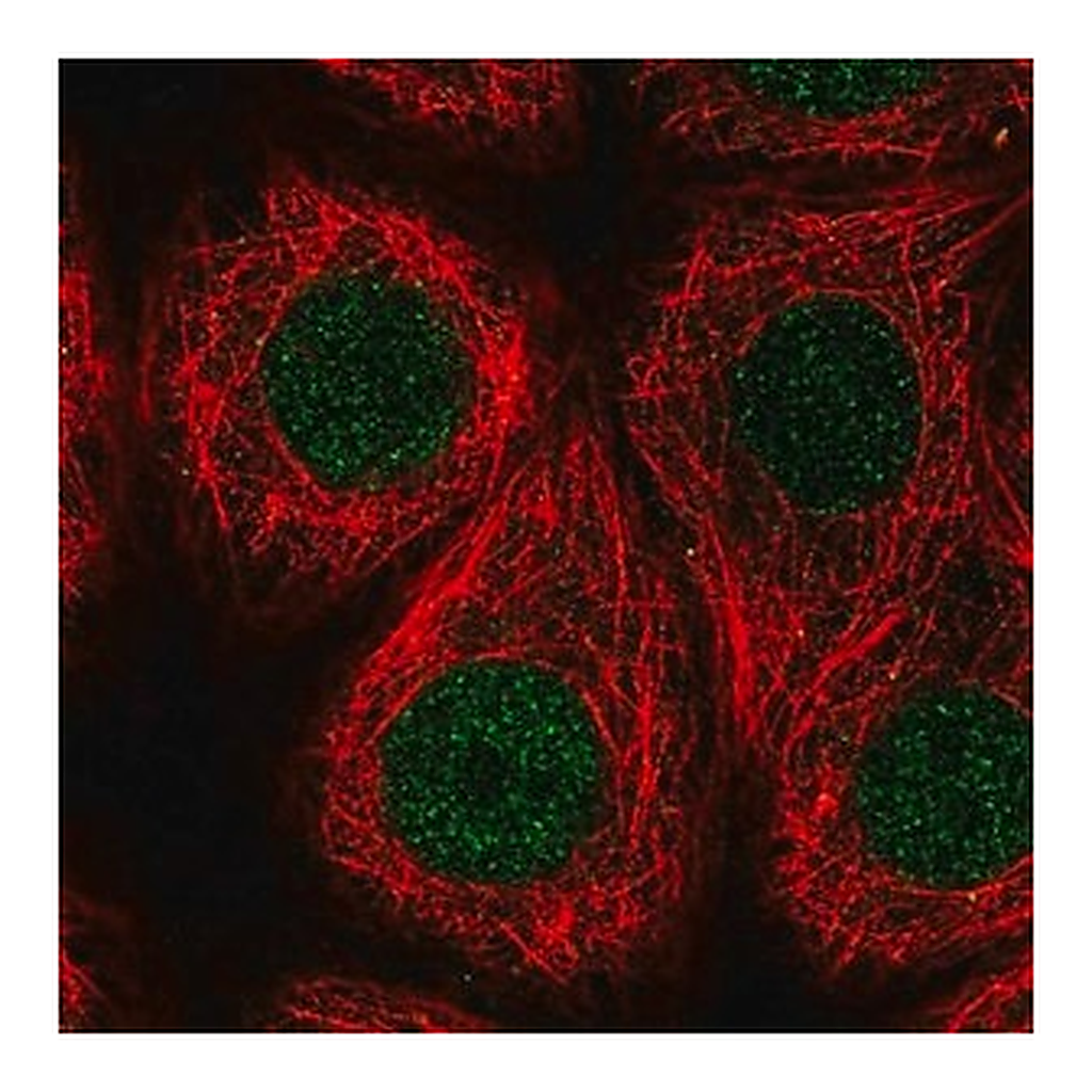 Merck Anti-RFWD3 antibody produced in rabbit