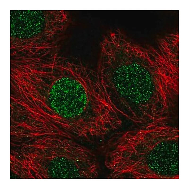 Merck Anti-CBFA2T3 antibody produced in rabbit