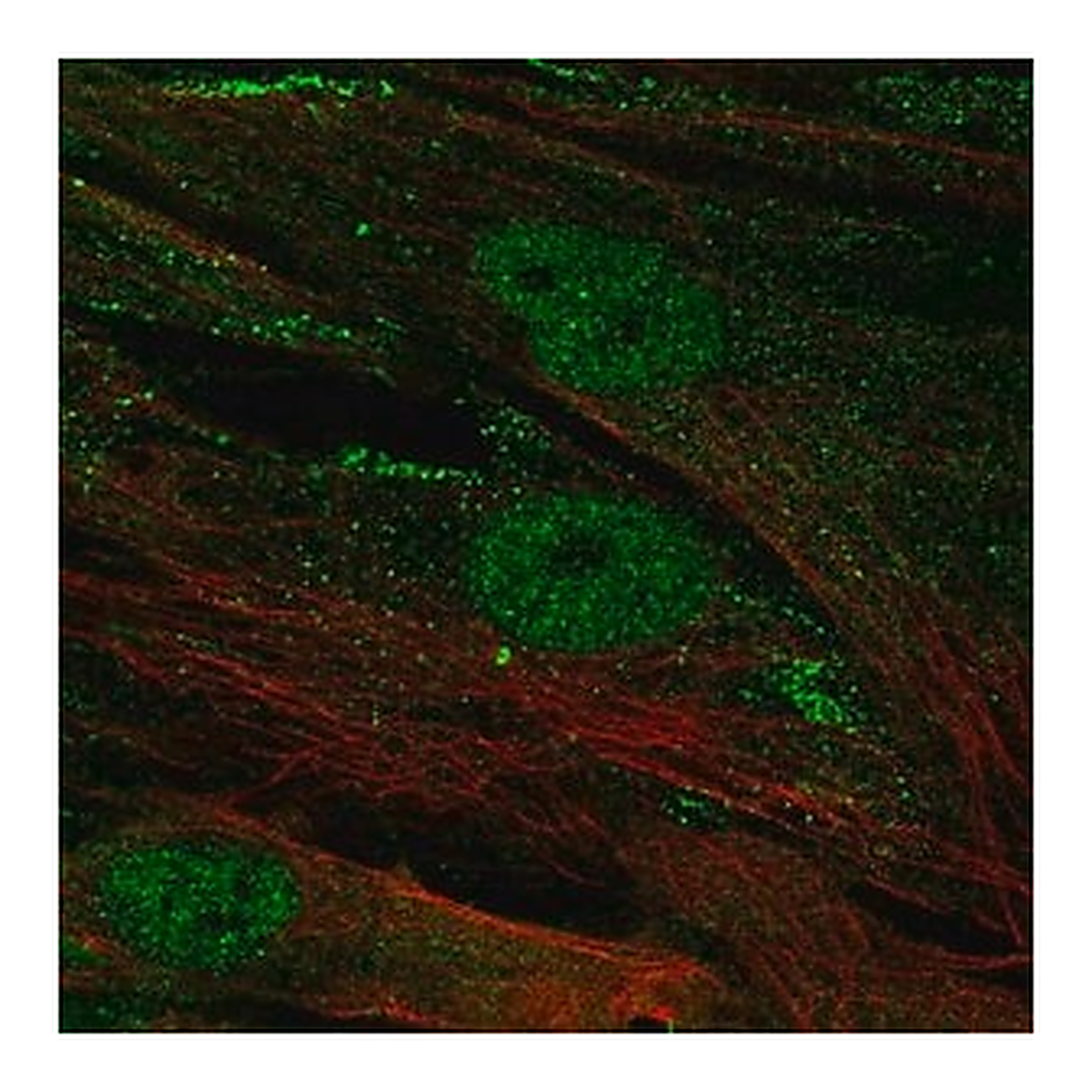 Merck Anti-CENPJ antibody produced in rabbit