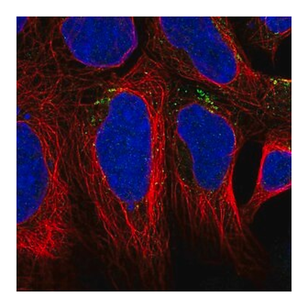 Merck Anti-AGPAT4 antibody produced in rabbit