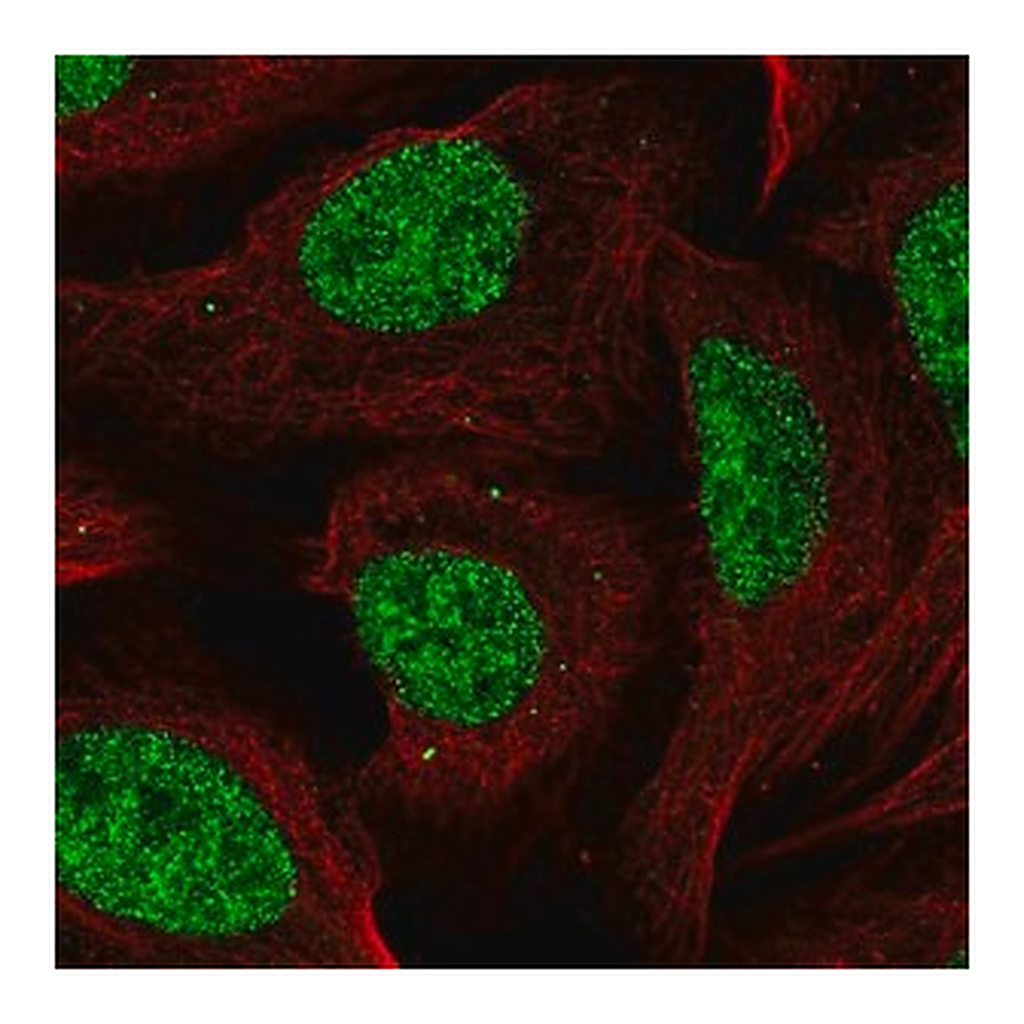 Merck Anti-CCDC12 antibody produced in rabbit