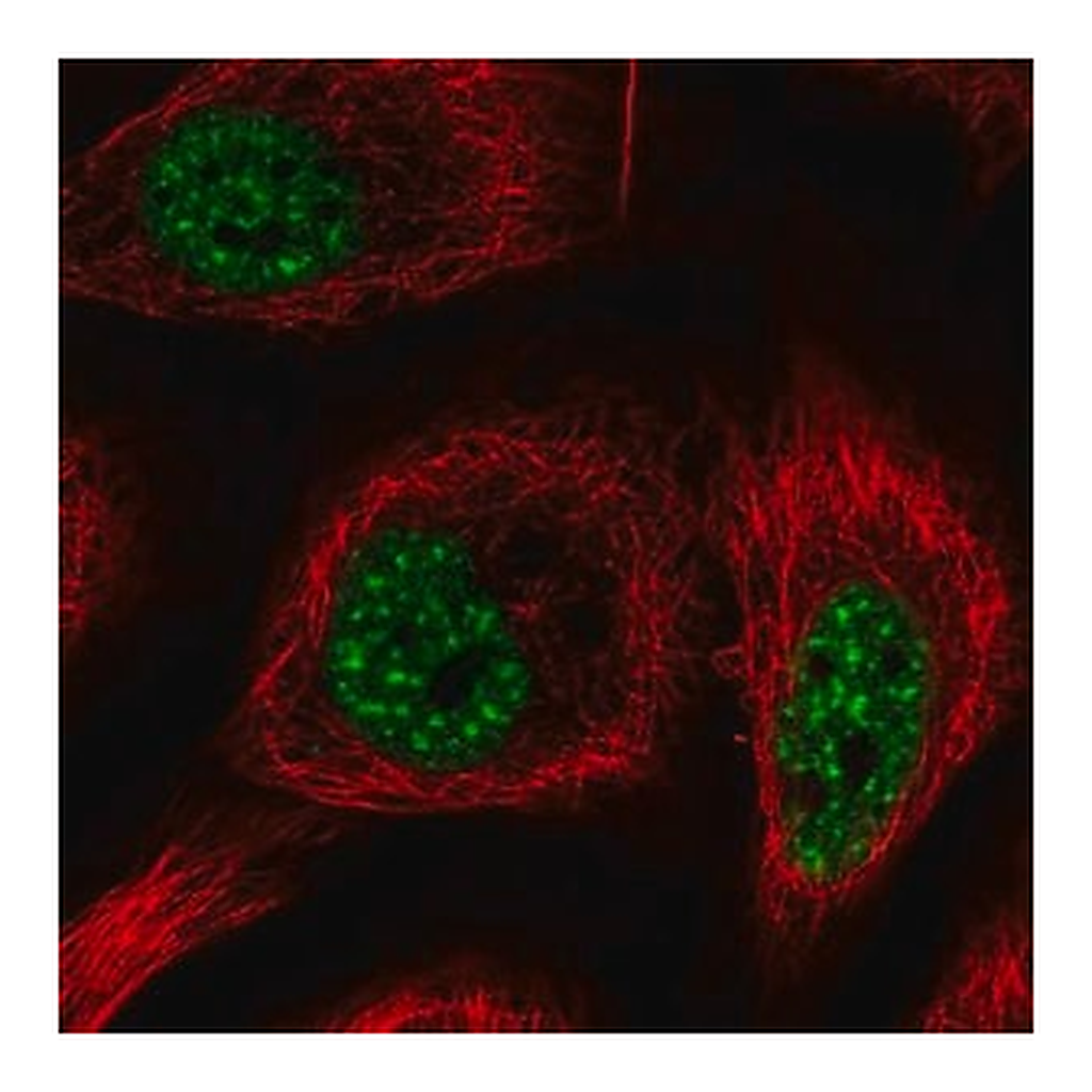 Merck Anti-RBM25 antibody produced in rabbit