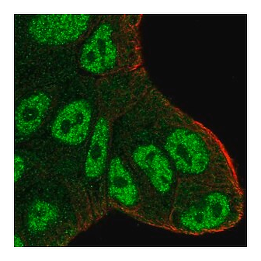 Merck Anti-ATXN1 antibody produced in rabbit