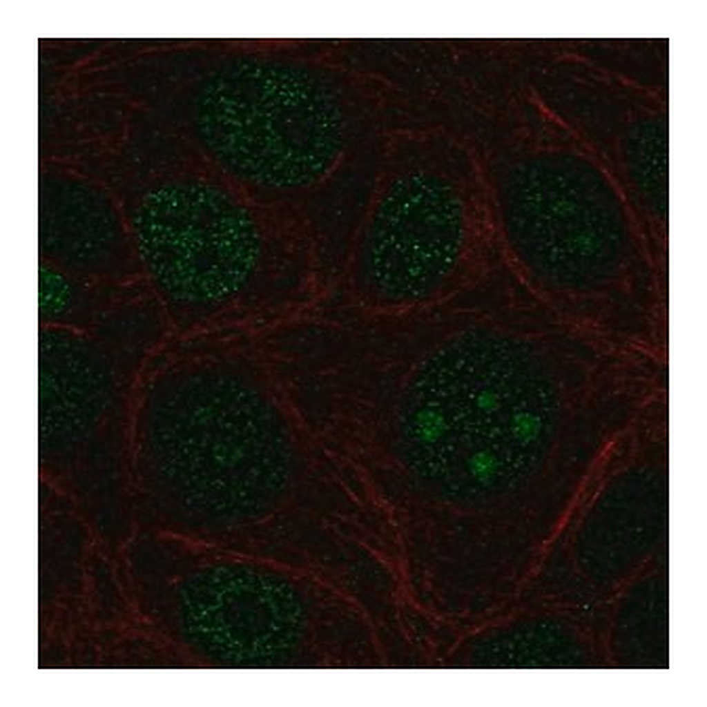 Merck Anti-ZBTB14 antibody produced in rabbit