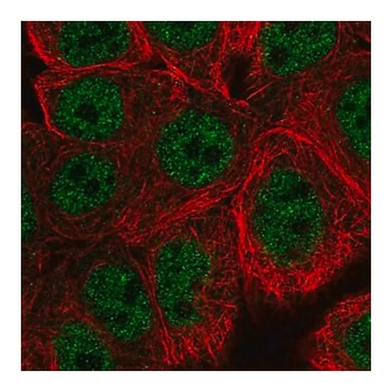 Merck Anti-WASHC5 antibody produced in rabbit