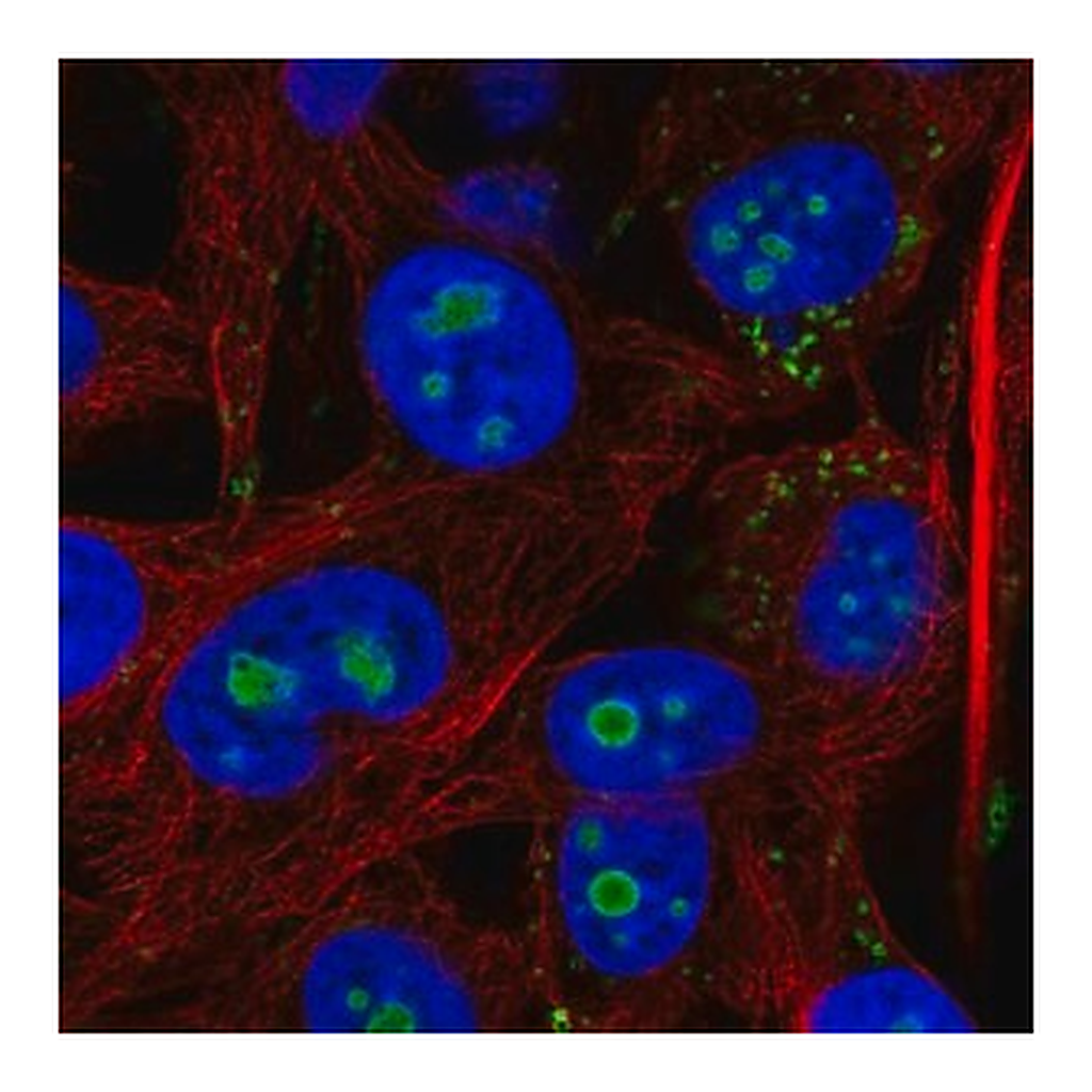 Merck Anti-ACSL3 antibody produced in rabbit