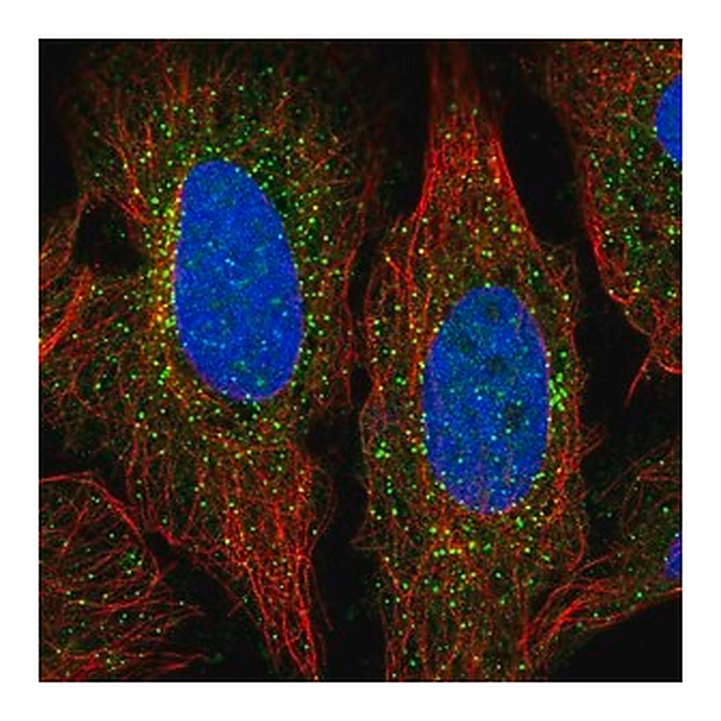 Merck Anti-ADAMTS7 antibody produced in rabbit