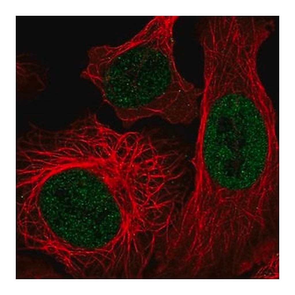 Merck Anti-EP400 antibody produced in rabbit