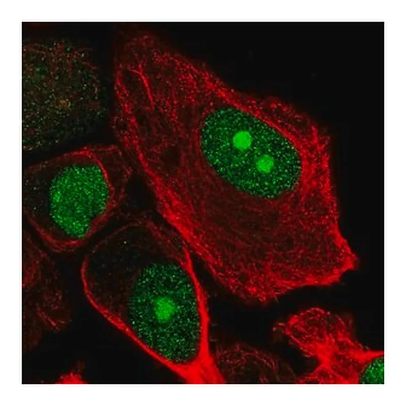 Merck Anti-RBBP5 antibody produced in rabbit