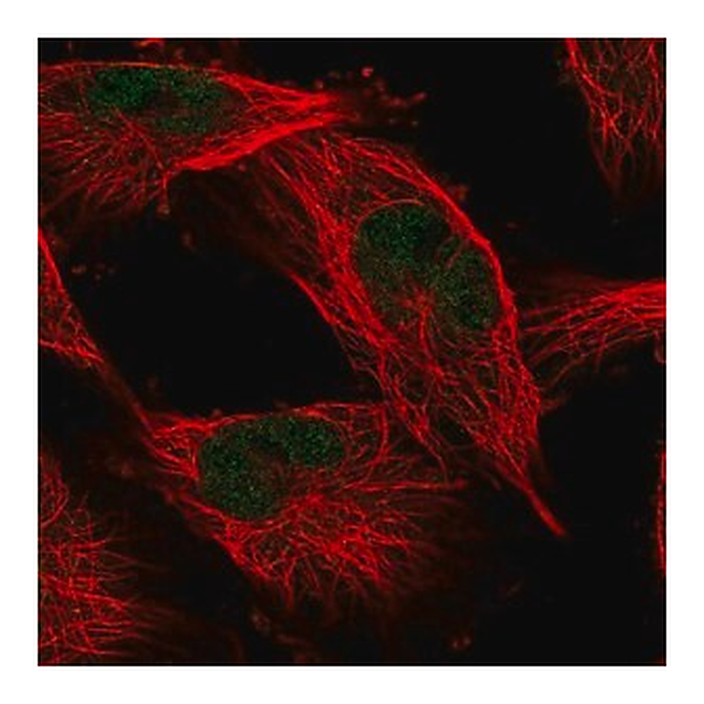 Merck Anti-COMMD1 antibody produced in rabbit