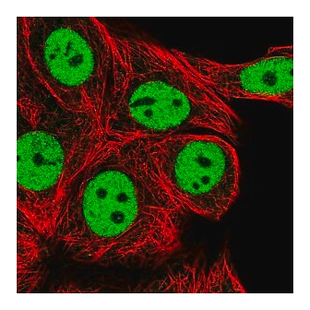 Merck Anti-RCOR1 antibody produced in rabbit