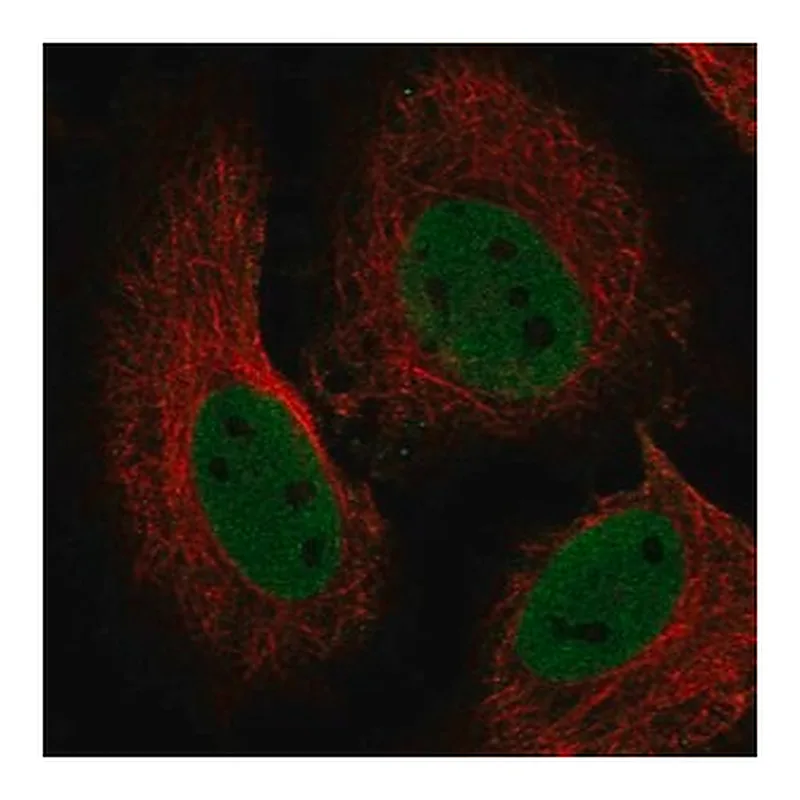 Merck Anti-RBBP4 antibody produced in rabbit