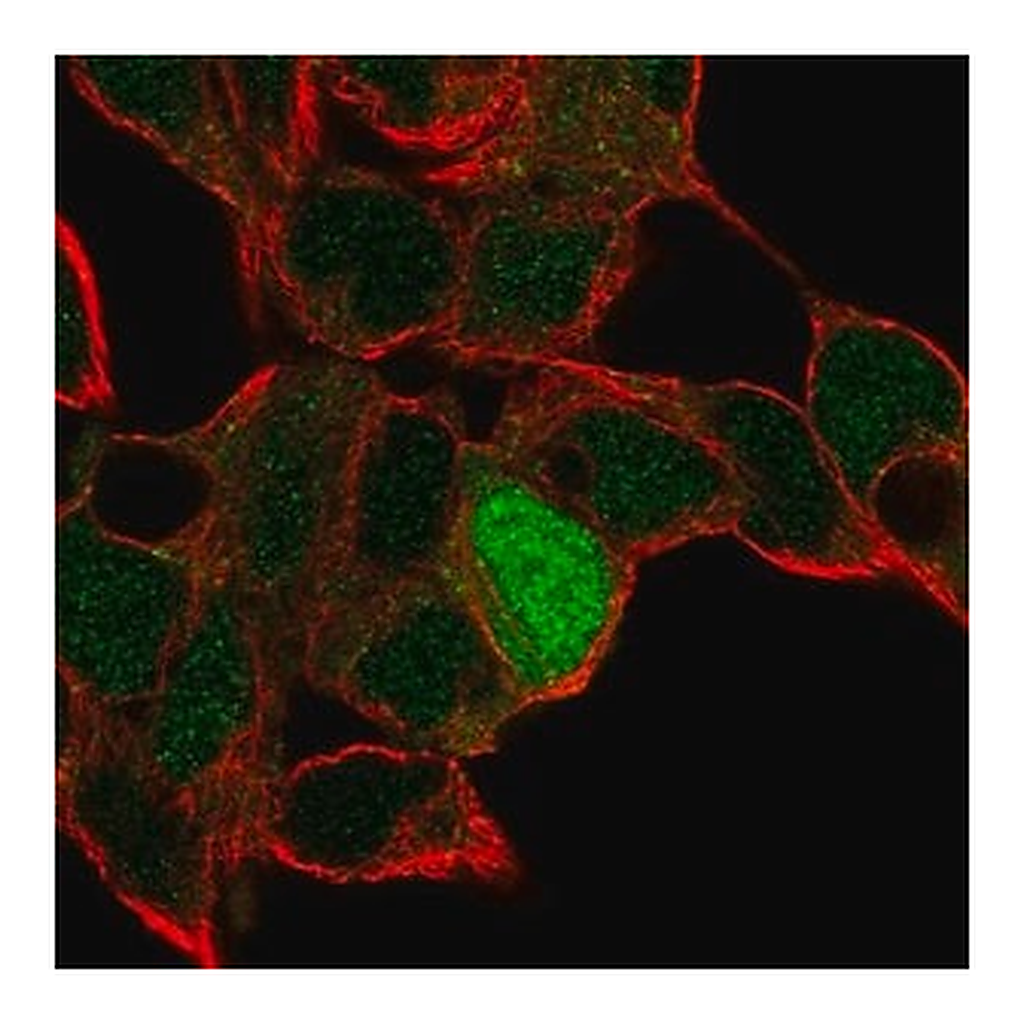 Merck Anti-ID4 antibody produced in rabbit