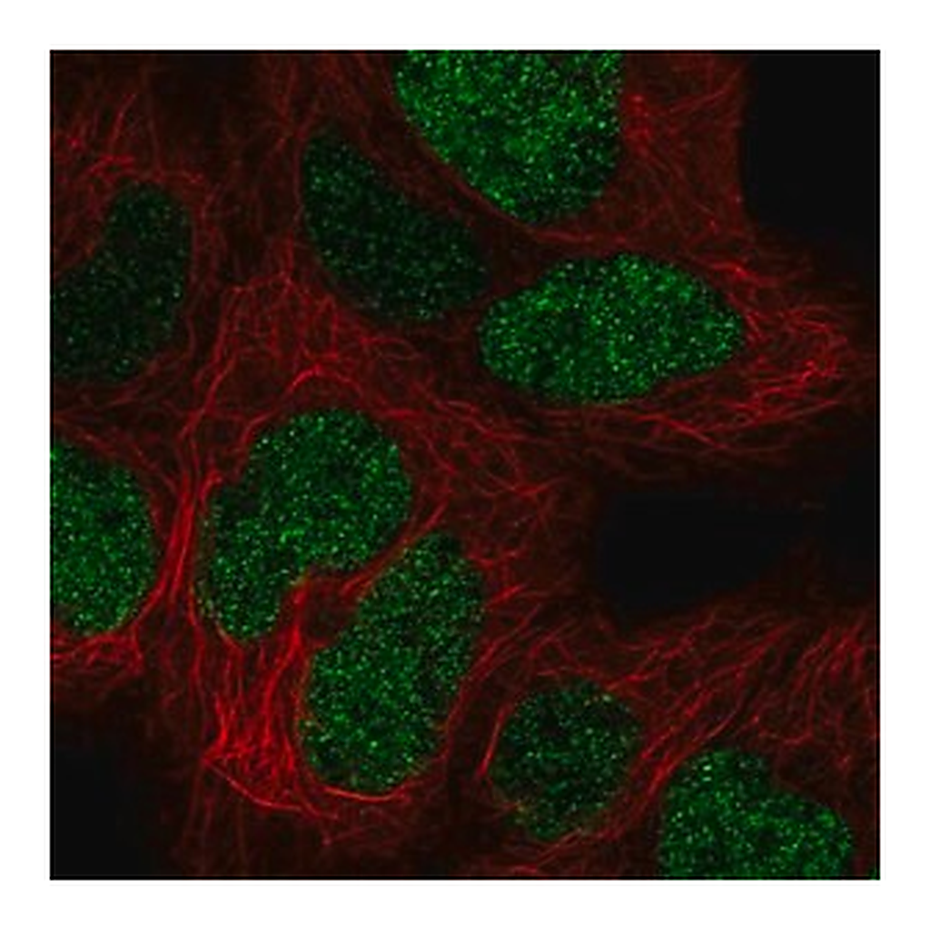 Merck Anti-CTR9 antibody produced in rabbit