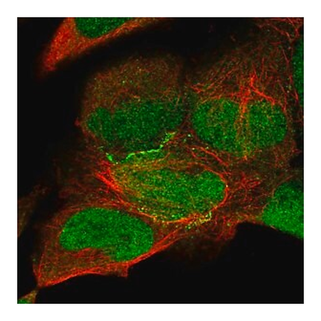 Merck Anti-KIAA0895 antibody produced in rabbit
