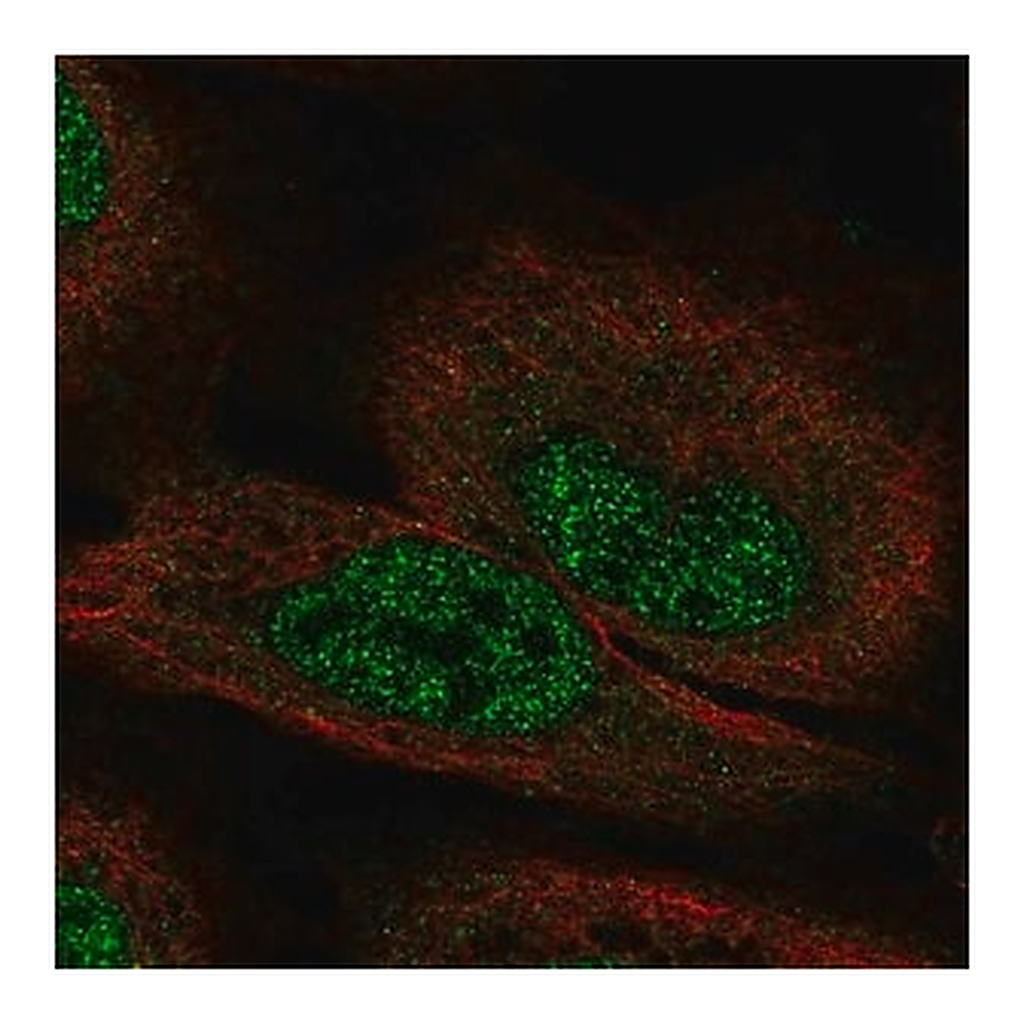 Merck Anti-FGF12 antibody produced in rabbit