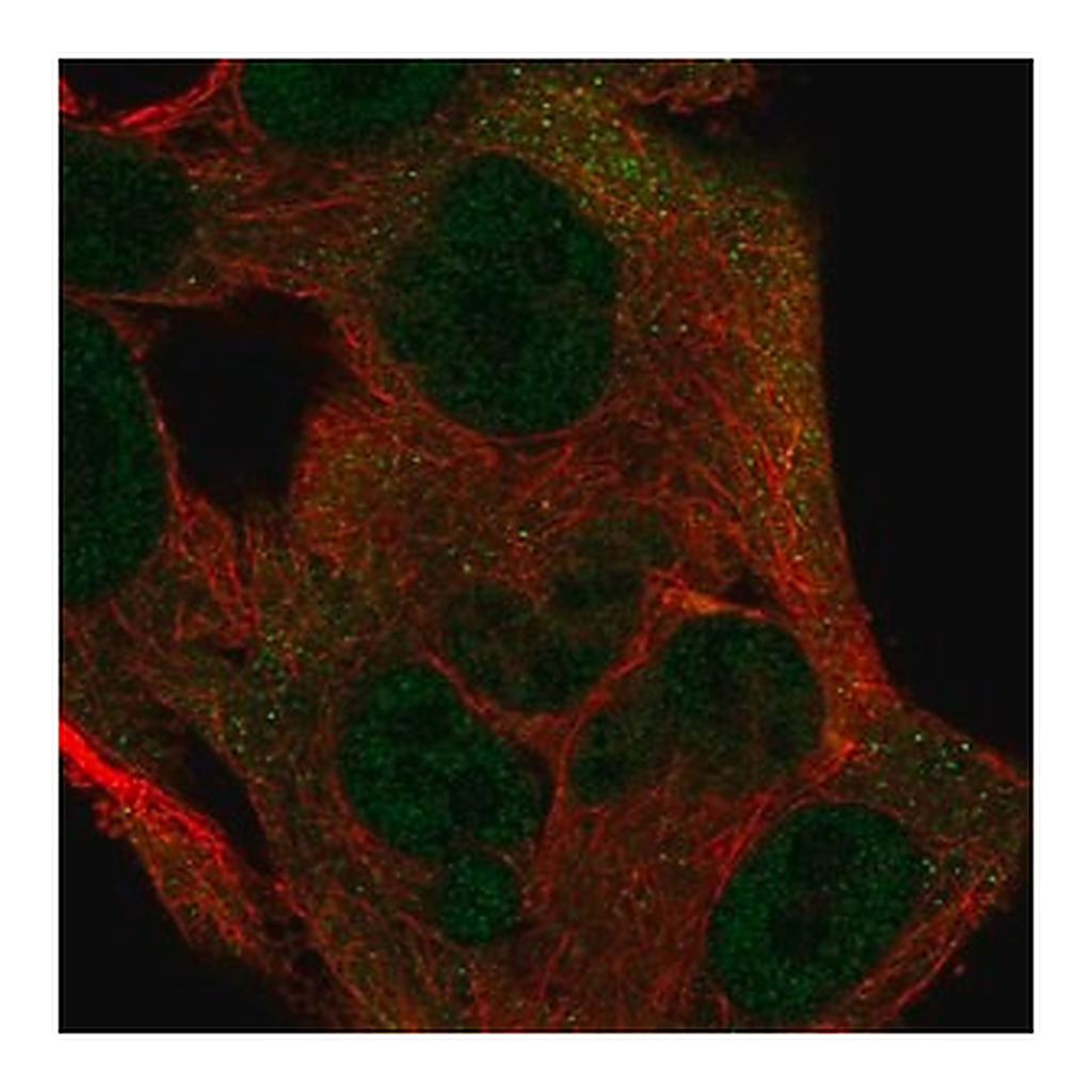 Merck Anti-ITGB1BP1 antibody produced in rabbit