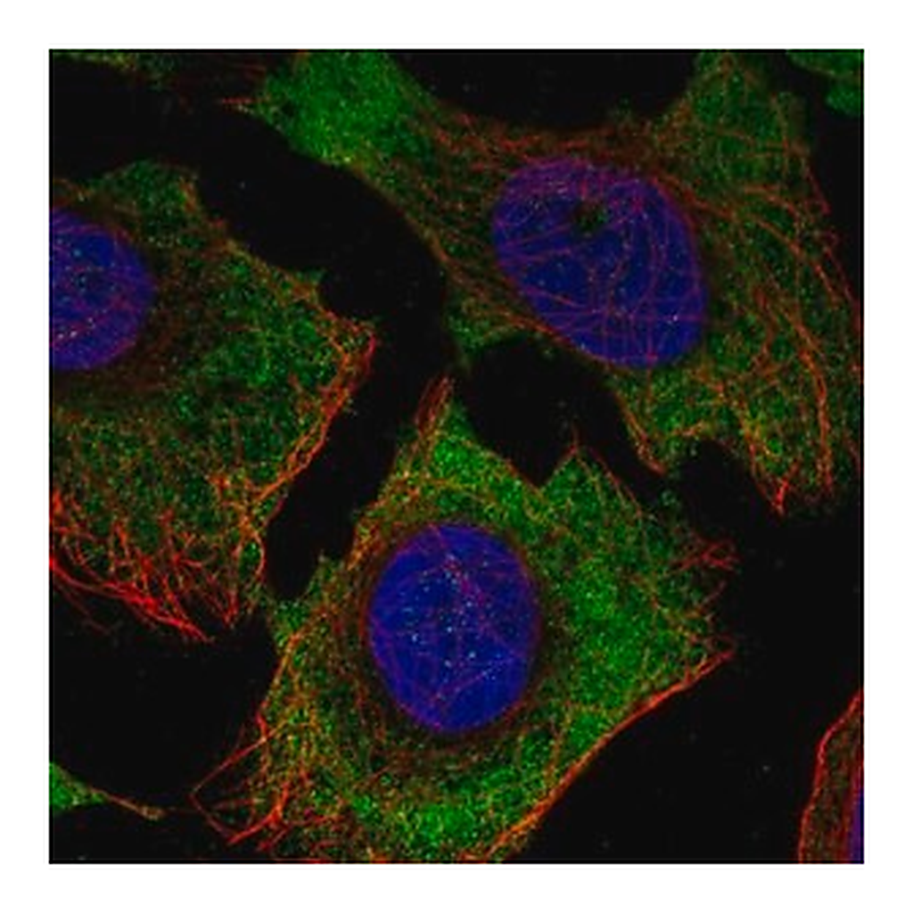 Merck Anti-ENTPD3 antibody produced in rabbit