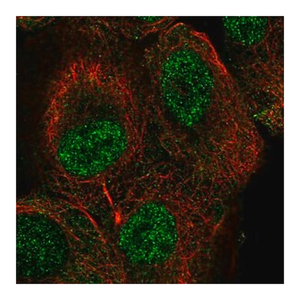 Merck Anti-TUT1 antibody produced in rabbit