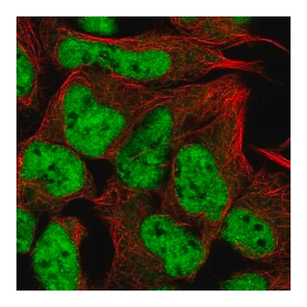 Merck Anti-RUNX1T1 antibody produced in rabbit