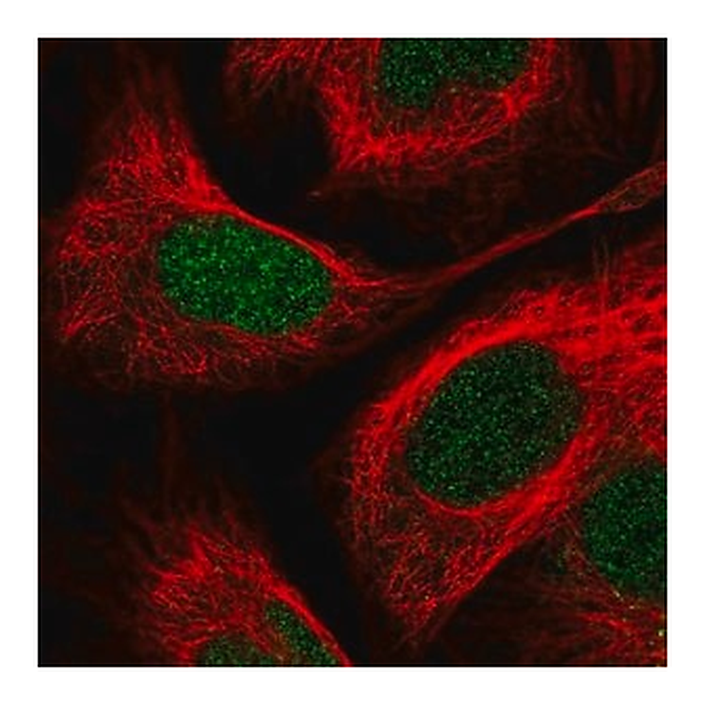 Merck Anti-PITX2 antibody produced in rabbit