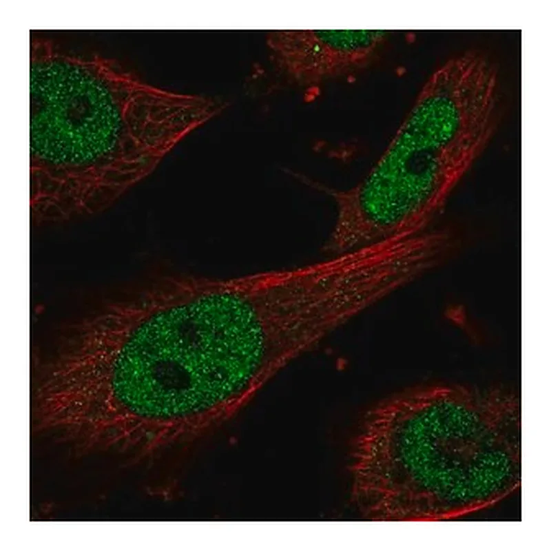 Merck Anti-ERCC1 antibody produced in rabbit