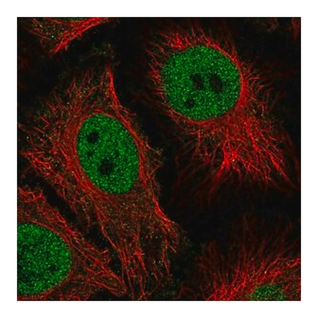 Merck Anti-HMG20B antibody produced in rabbit