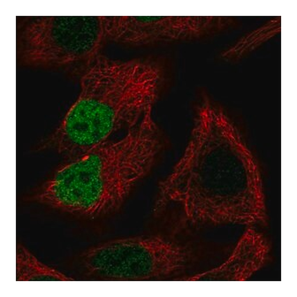 Merck Anti-MORC4 antibody produced in rabbit