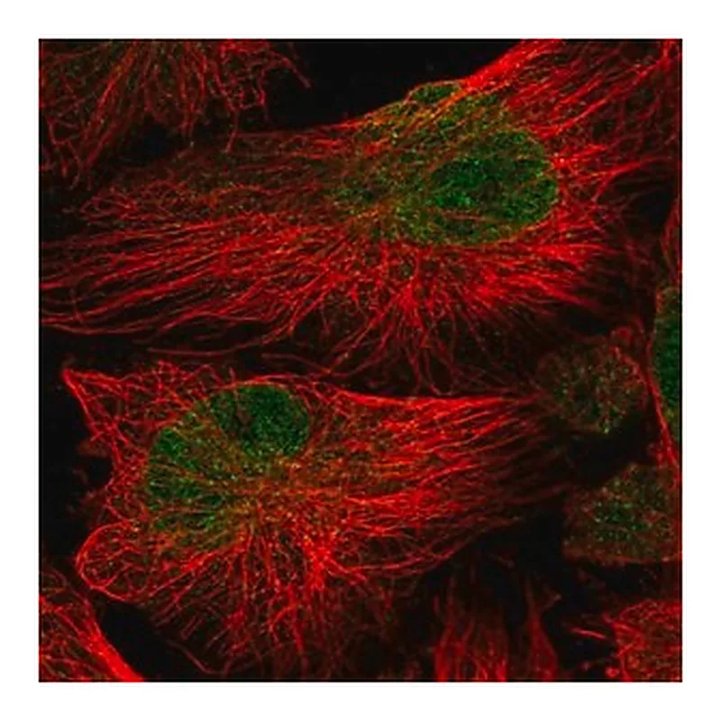 Merck Anti-ATG16L2 antibody produced in rabbit