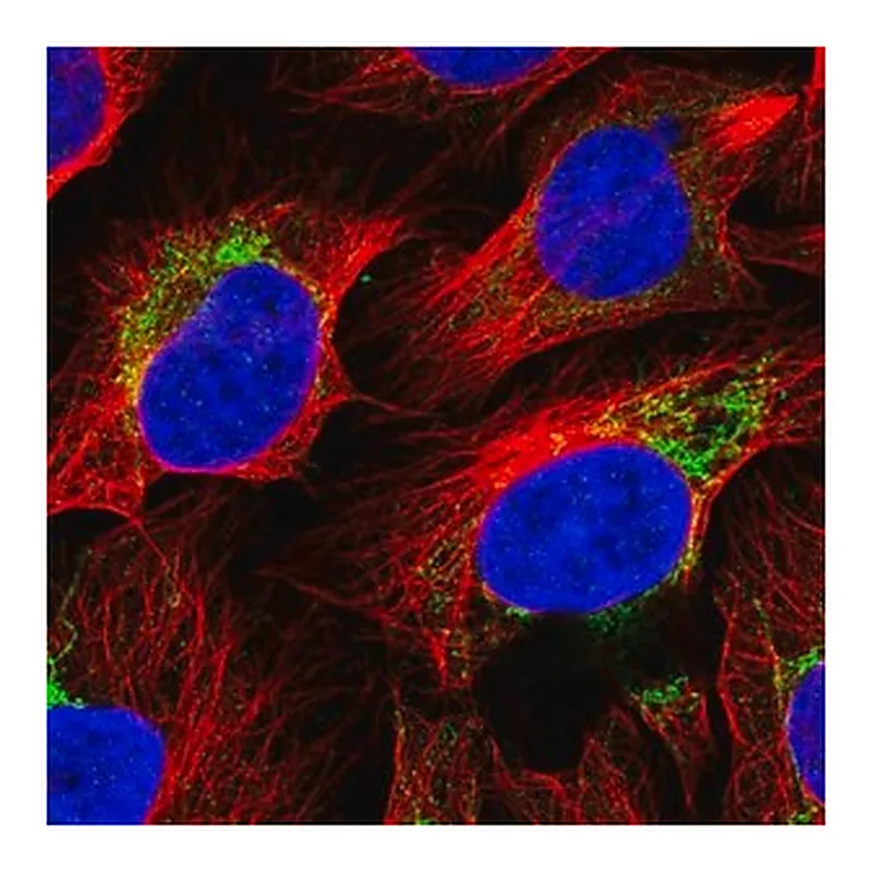 Merck Anti-ACSS3 antibody produced in rabbit