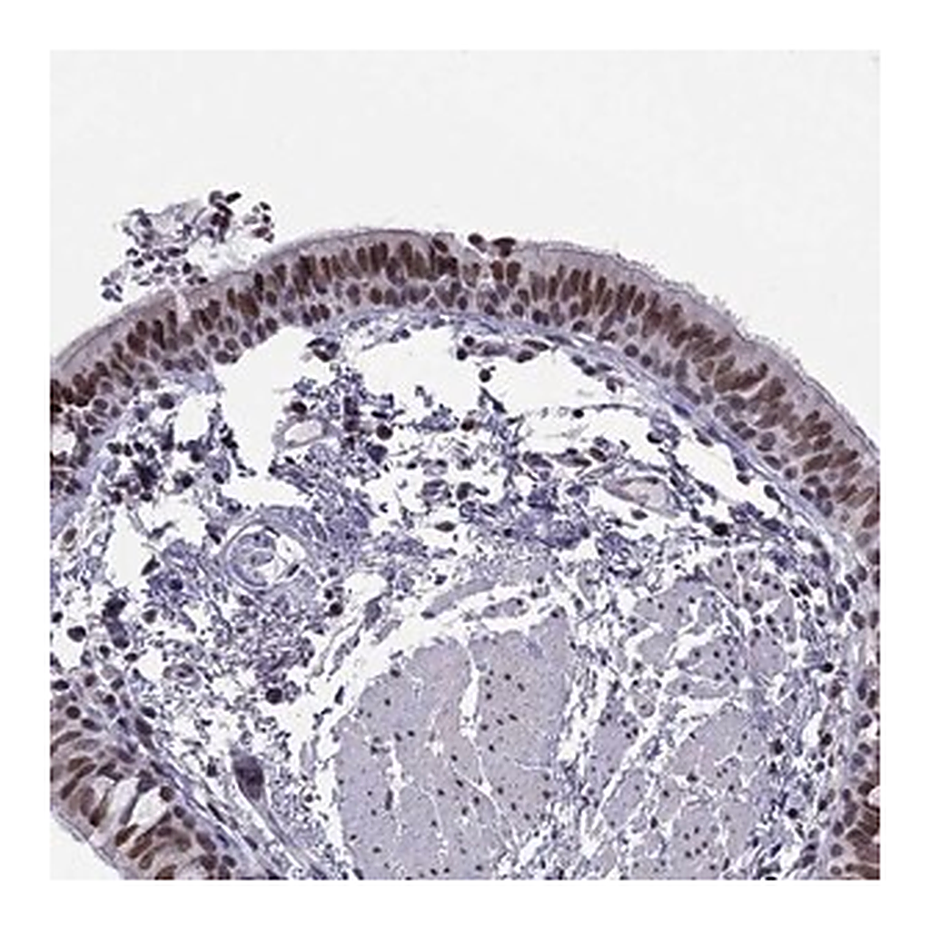 Merck Anti-RPRD2 antibody produced in rabbit