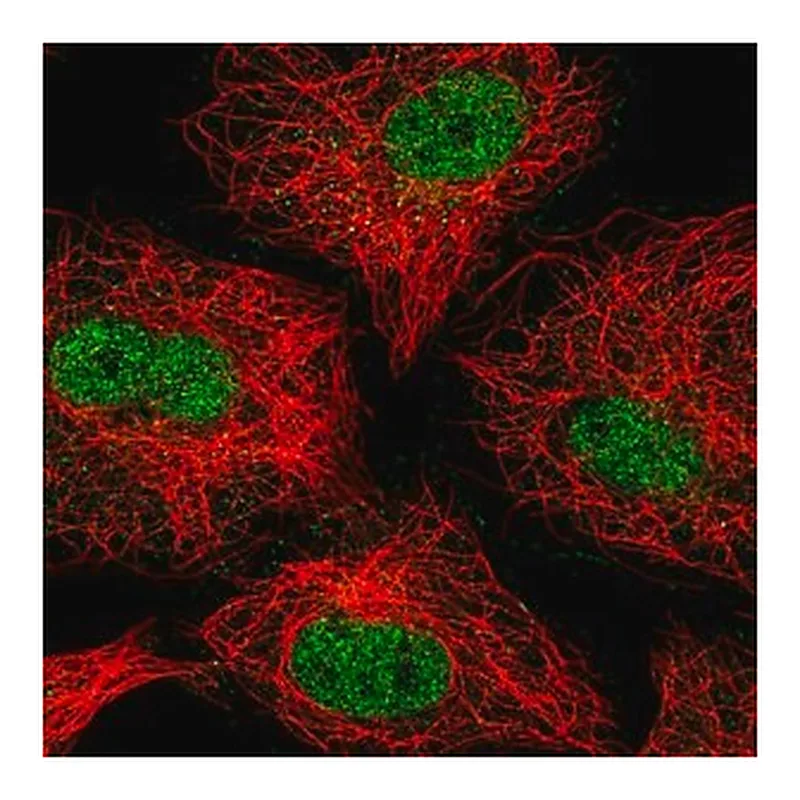Merck Anti-ZNF618 antibody produced in rabbit