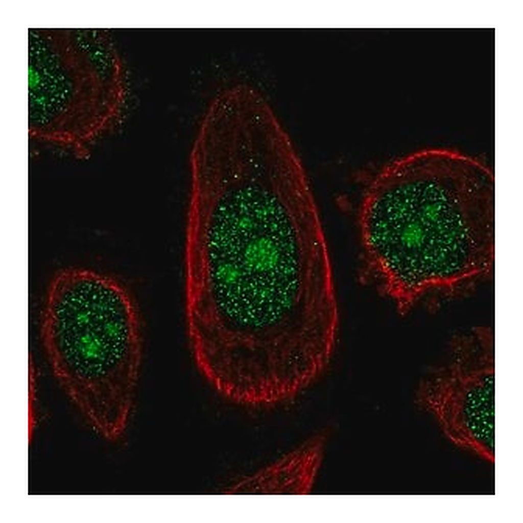 Merck Anti-ZNF16 antibody produced in rabbit