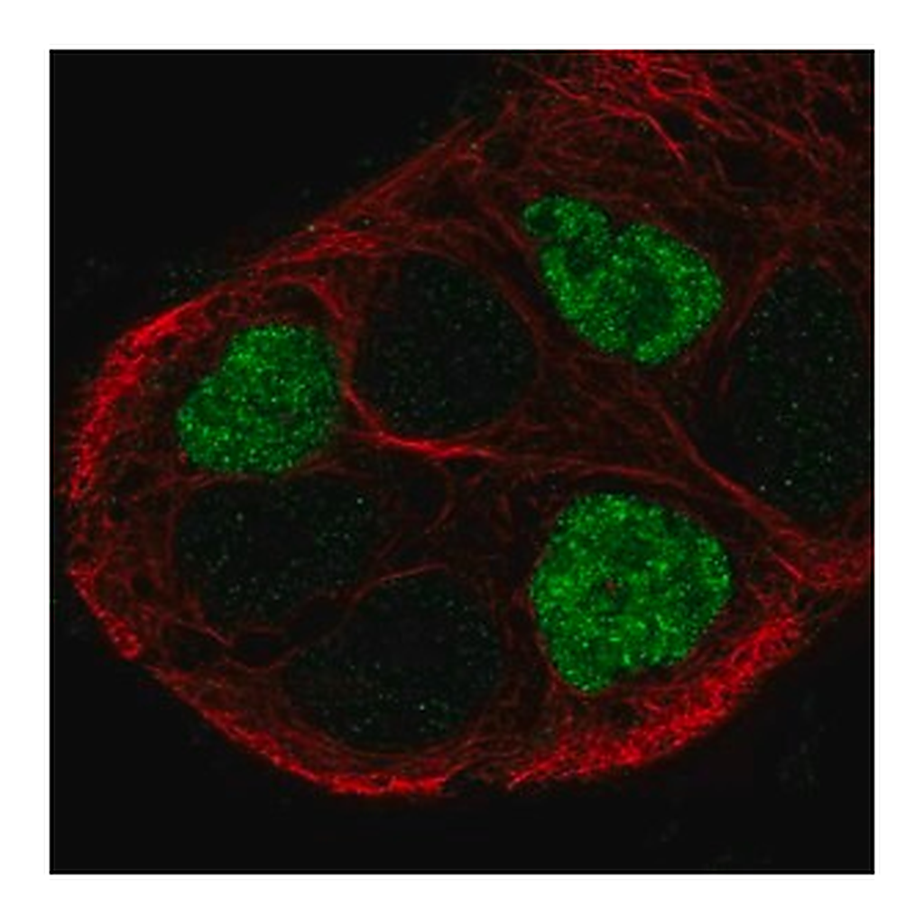 Merck Anti-GPR161 antibody produced in rabbit