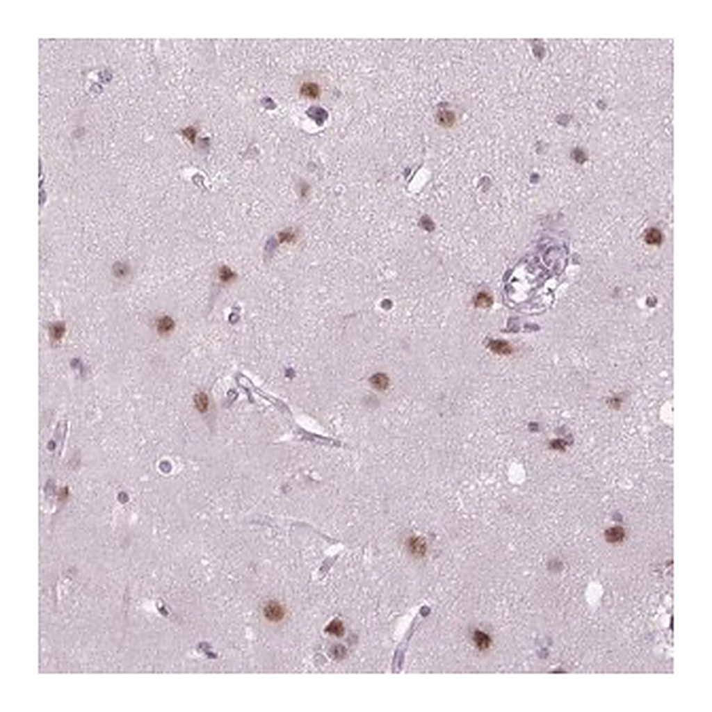 Merck Anti-MAGEB3 antibody produced in rabbit