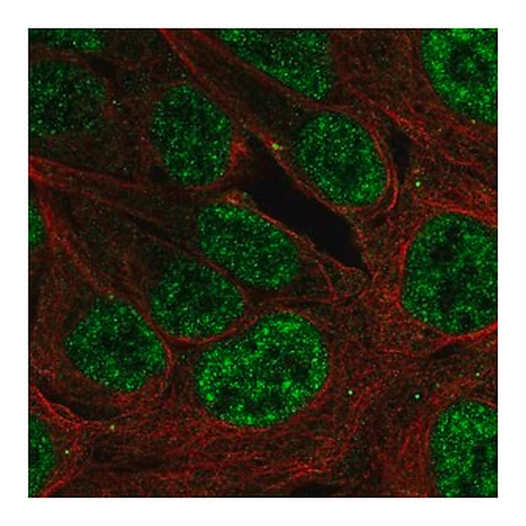 Merck Anti-PLAG1 antibody produced in rabbit