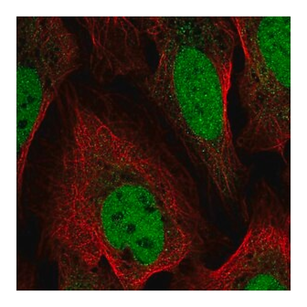 Merck Anti-YEATS4 antibody produced in rabbit