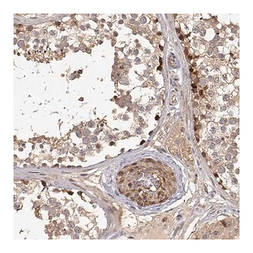 Merck Anti-PICK1 antibody produced in rabbit