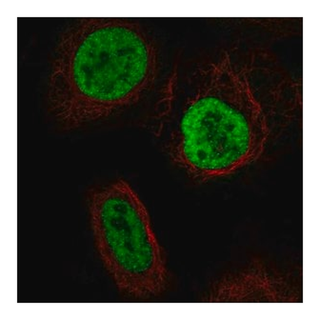 Merck Anti-YTHDC2 antibody produced in rabbit