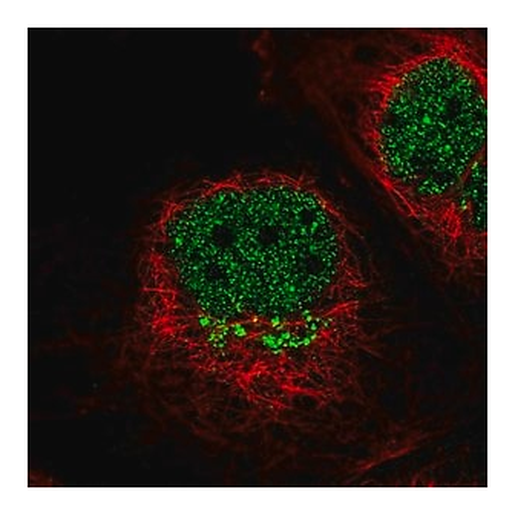 Merck Anti-IL13RA1 antibody produced in rabbit
