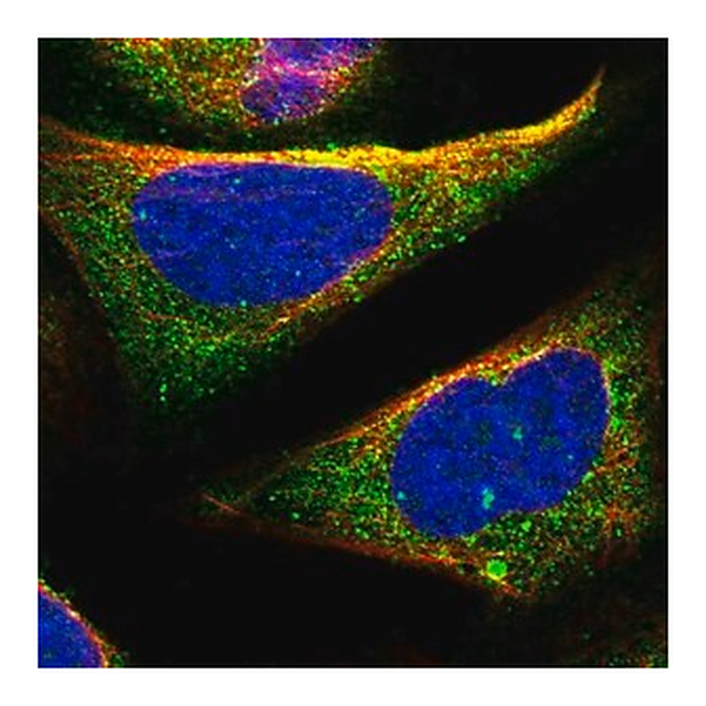Merck Anti-TOM1 antibody produced in rabbit