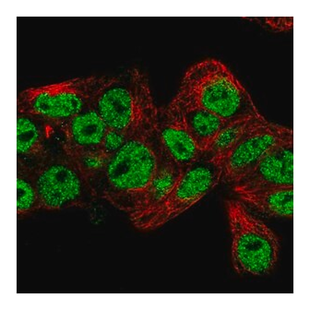 Merck Anti-PROX1 antibody produced in rabbit
