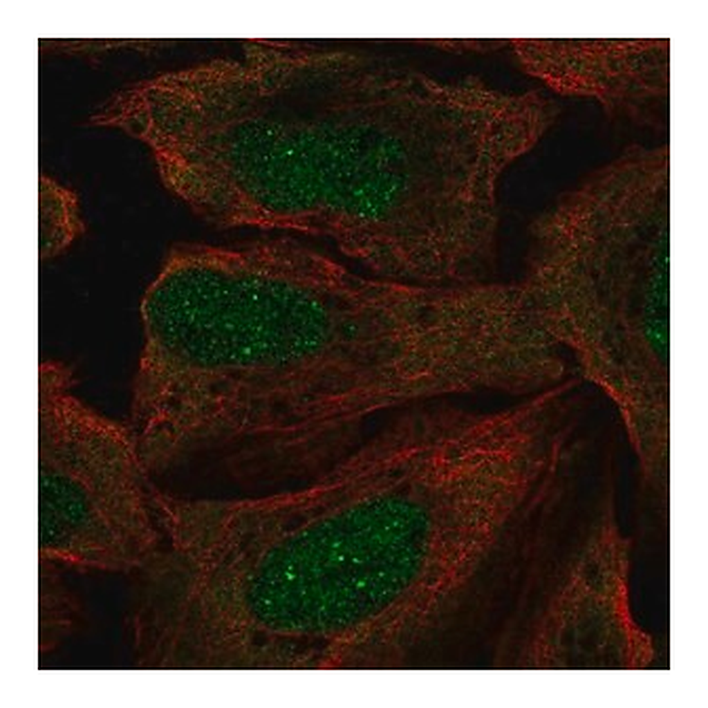 Merck Anti-RP2 antibody produced in rabbit