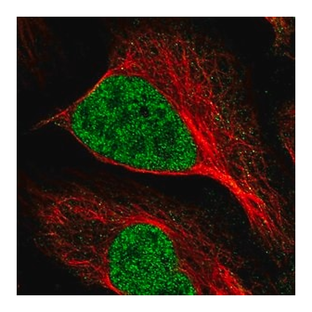 Merck Anti-MNAT1 antibody produced in rabbit